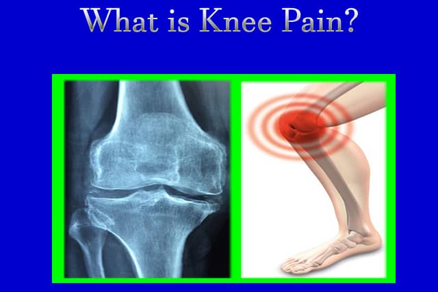 What- Knee- Pain
